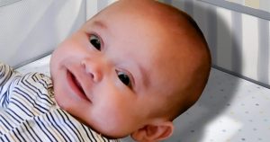 Penyakit bayi kepala membesar
