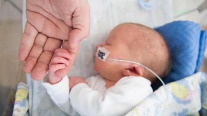 kelebihan bayi prematur